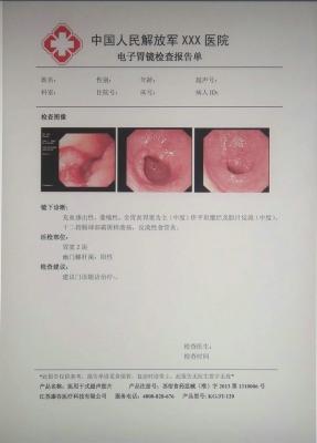 kg/jt-120醫用干式膠片