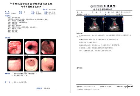 mha-pb5醫用打印膠片