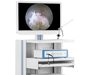 冠龍醫(yī)用內(nèi)窺鏡攝像系統(tǒng)ys-iii